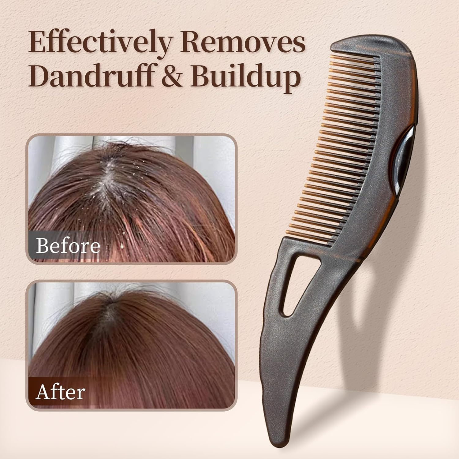 Self-Cleaning Dandruff Comb with Hollow Teeth, Scalp Massage Comb for Flake Removal, Oil Control & Scalp Detox, Hair Care Tool for Women, Men and Kids