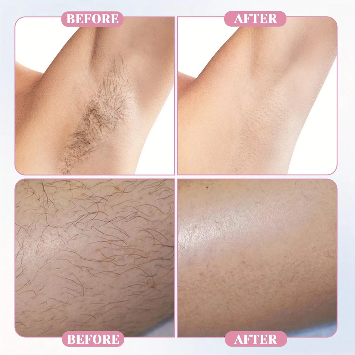 Reusable Crystal Hair Eraser for Women & Men, Manual Glass Hair Remover for Arms, Legs & Body